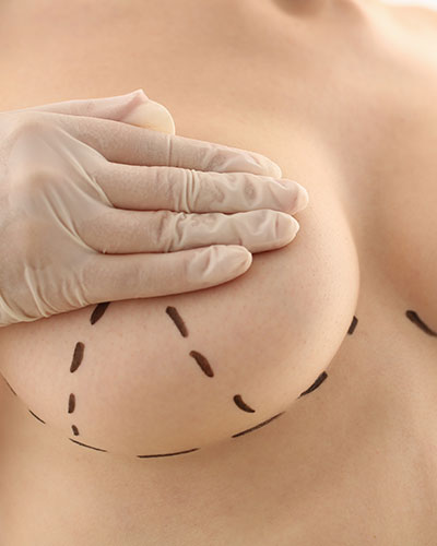 Breast Aesthetic Surgeon in Vijayawada