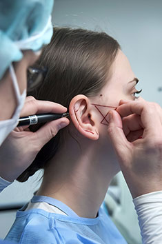 Otoplasty