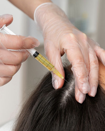 PRP Hair Treatment in Vijayawada